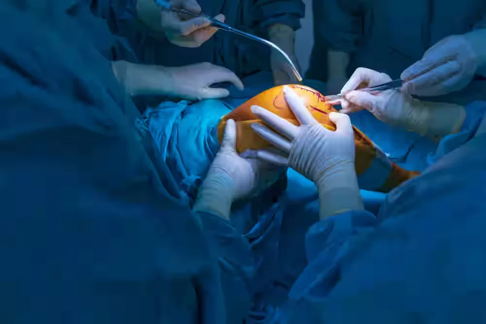 Orthopaedic Surgeons in Erode for Knee Replacement & Bone Surgery | Sri Vijaya Hitech Hospital