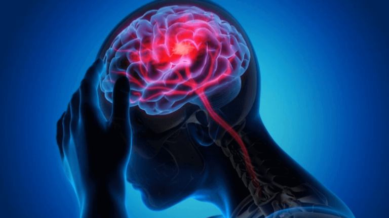 Find Expert Neurology Treatment in Erode – Consult Today at Sri Vijaya Hitech Hospital